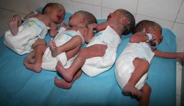 Djelfa : Naissance de quadruplés à l’hôpital Mère-Enfant